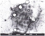 Fig. 14. Optical glass, Porto Allegre, Brasil: spot corrosion of the
                            glass surface following mould attack (‘bio-pitting’).